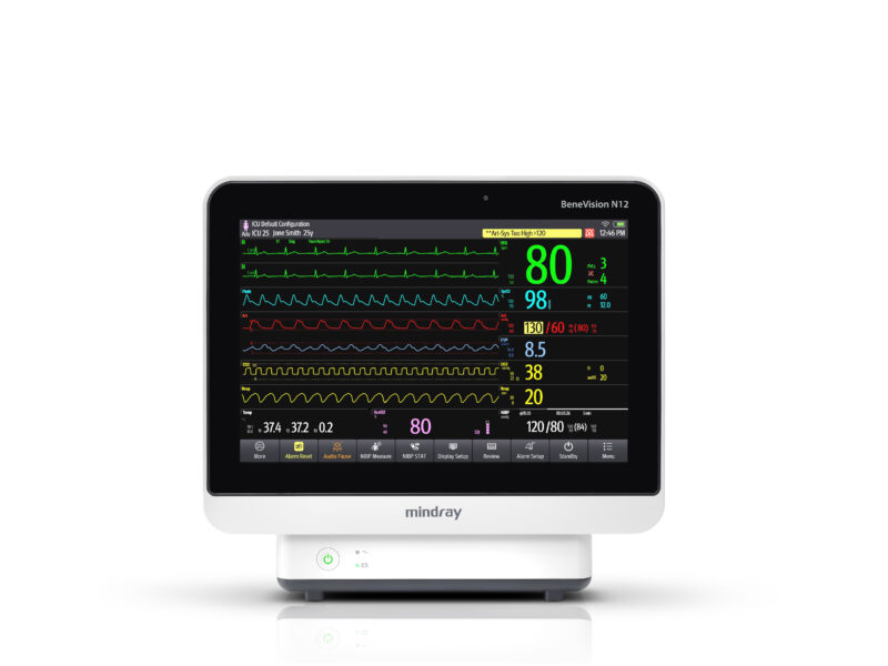 Mindray BeneVision N Series Patient Monitor (N22, N19, N17, N15, N12) – High-End Monitor for ICU and Operating Room