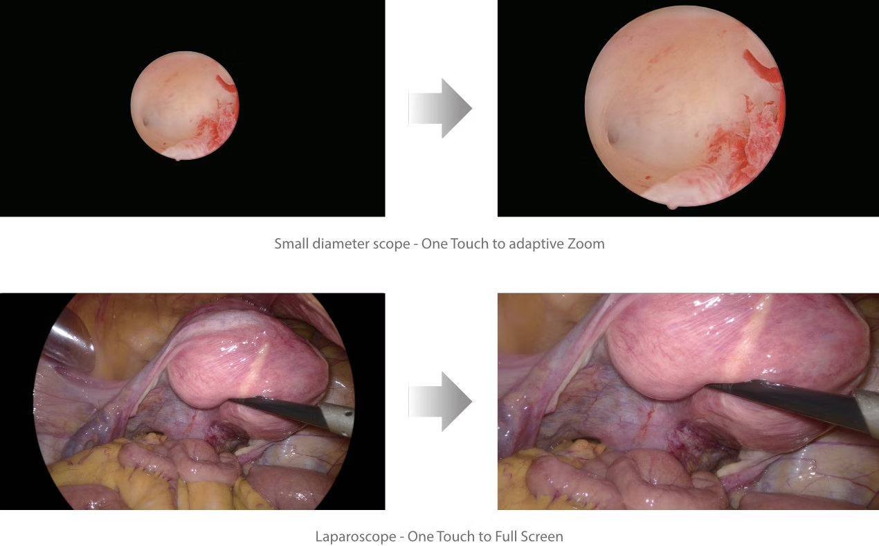 4K Endoscopic System UX3 - 2