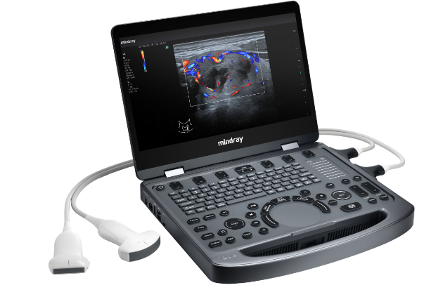 Compact Ultrasound System MX3