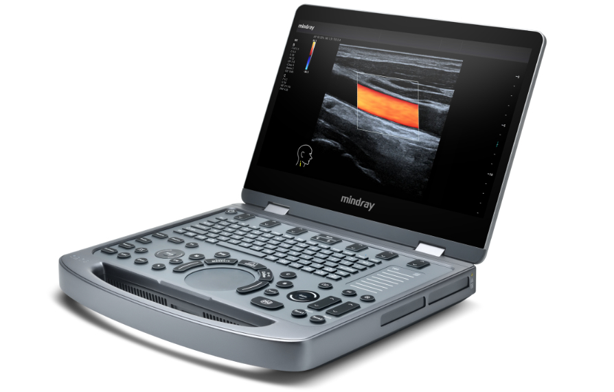 Compact Ultrasound System MX3 - 2